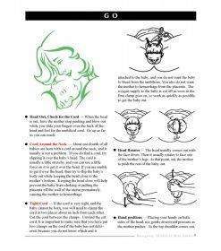 Emergency Childbirth Mini Guide | Birth & Women's Health Resource 23 Emergency Childbirth Mini Guide 10