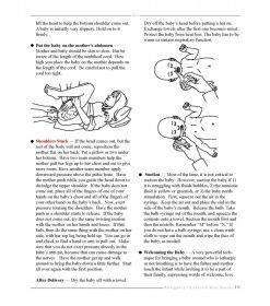 Emergency Childbirth Mini Guide | Birth & Women's Health Resource 24 Emergency Childbirth Mini Guide 11