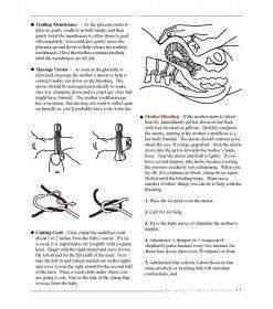 Emergency Childbirth Mini Guide | Birth & Women's Health Resource 26 Emergency Childbirth Mini Guide 13
